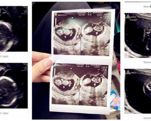 国内有哪家医院可以供卵检,乌鲁木齐一年中做试管的比较佳时间