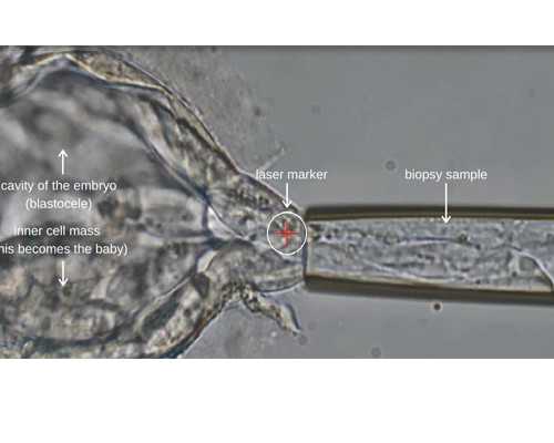 国内代生孩子成功率,(全民健康热点)海口染色体缺失可以做试管婴儿吗